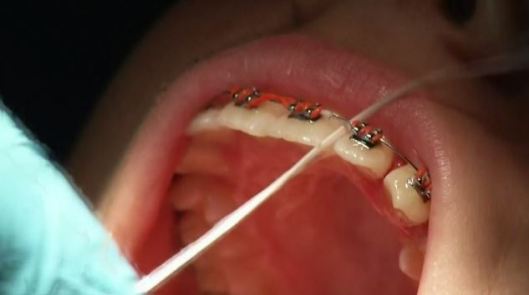 dental-floss_1470146460809_1788496_ver1-0